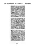 Novel population of multipotent cardiac precursor cells derived from human blastocysts derived stem cells diagram and image