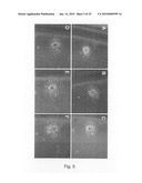 Novel population of multipotent cardiac precursor cells derived from human blastocysts derived stem cells diagram and image