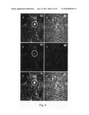 Novel population of multipotent cardiac precursor cells derived from human blastocysts derived stem cells diagram and image