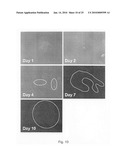 Novel population of multipotent cardiac precursor cells derived from human blastocysts derived stem cells diagram and image