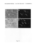 Novel population of multipotent cardiac precursor cells derived from human blastocysts derived stem cells diagram and image