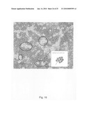 Novel population of multipotent cardiac precursor cells derived from human blastocysts derived stem cells diagram and image