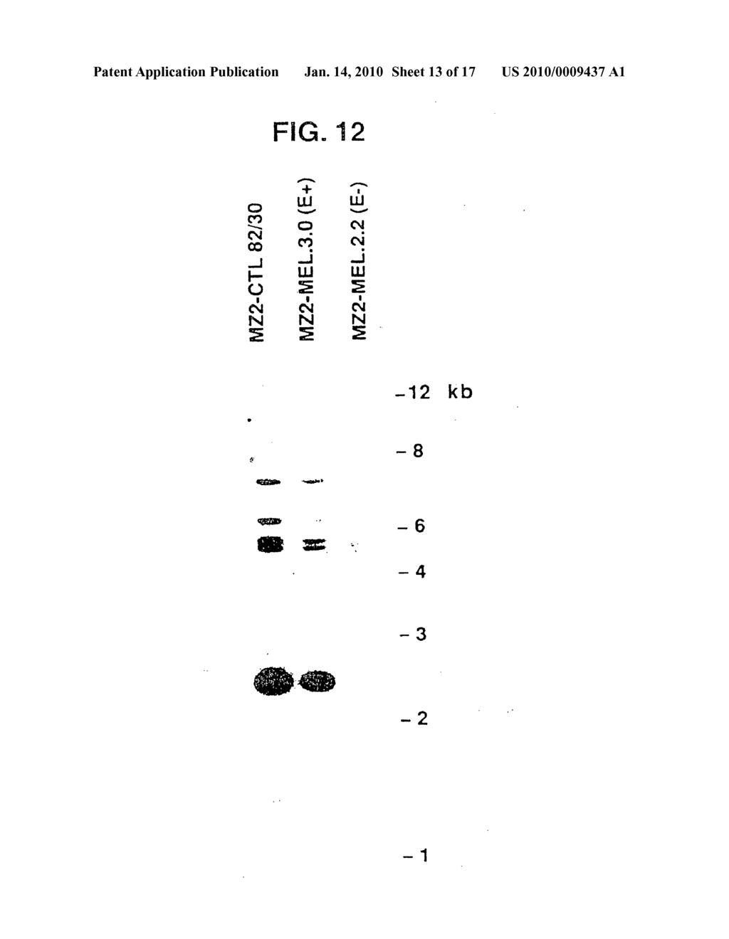 Isolated proteins MAGE-4 and MAGE-41 - diagram, schematic, and image 14