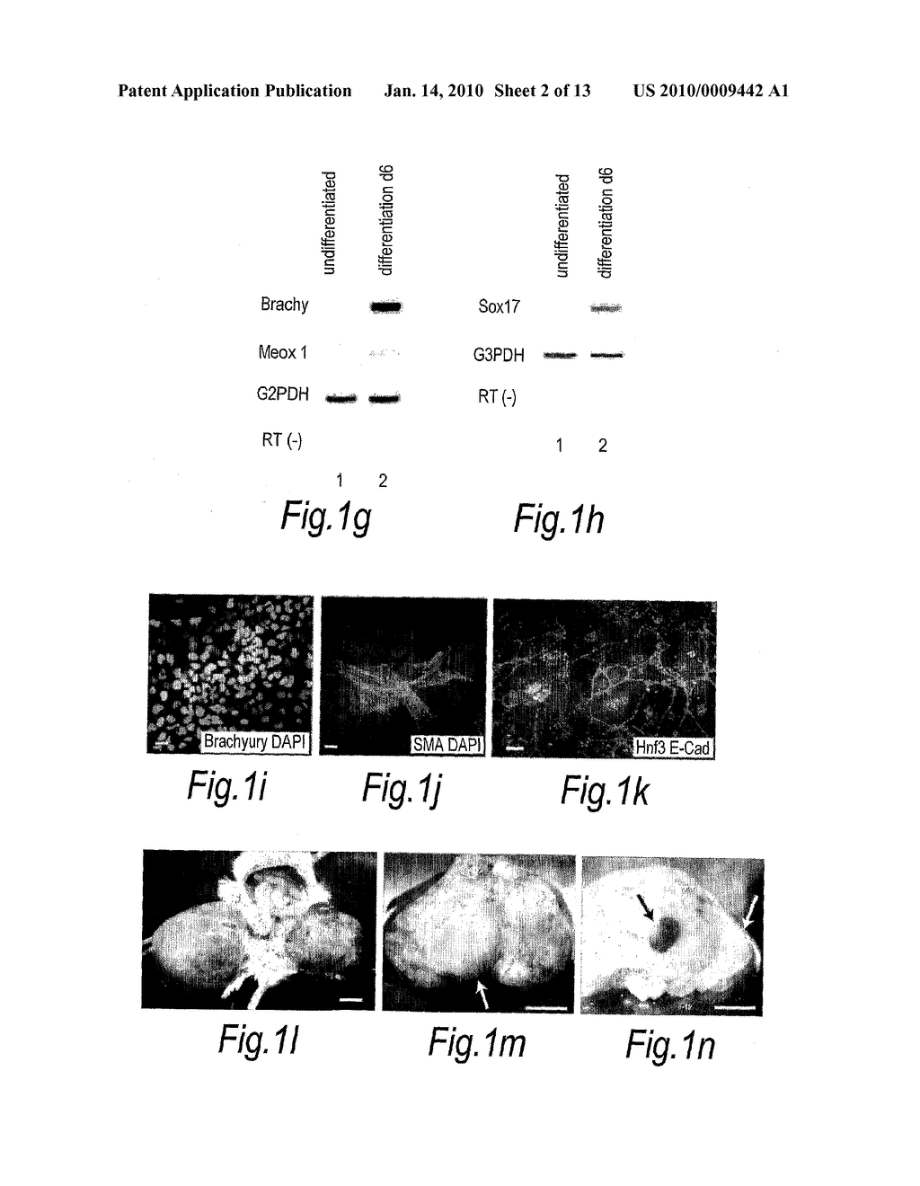 Stem Cell Culture Medium and Method - diagram, schematic, and image 03