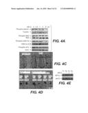 COMPOSITIONS INCLUDING TRICIRIBINE AND TAXANES AND METHODS OF USE THEREOF diagram and image