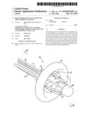 Brachytherapy device with one or more toroidal balloons diagram and image