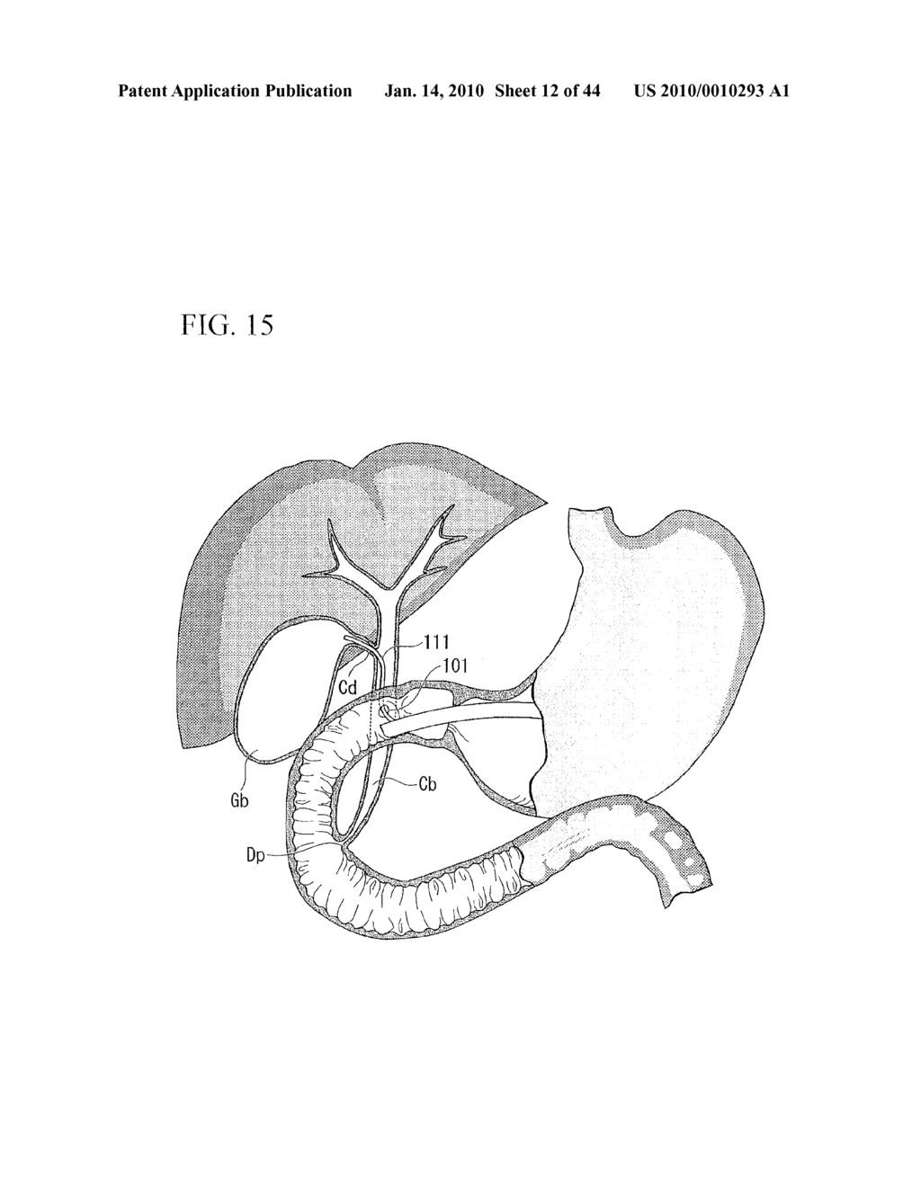 TREATMENT METHOD - diagram, schematic, and image 13