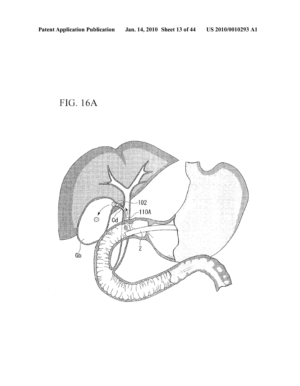 TREATMENT METHOD - diagram, schematic, and image 14