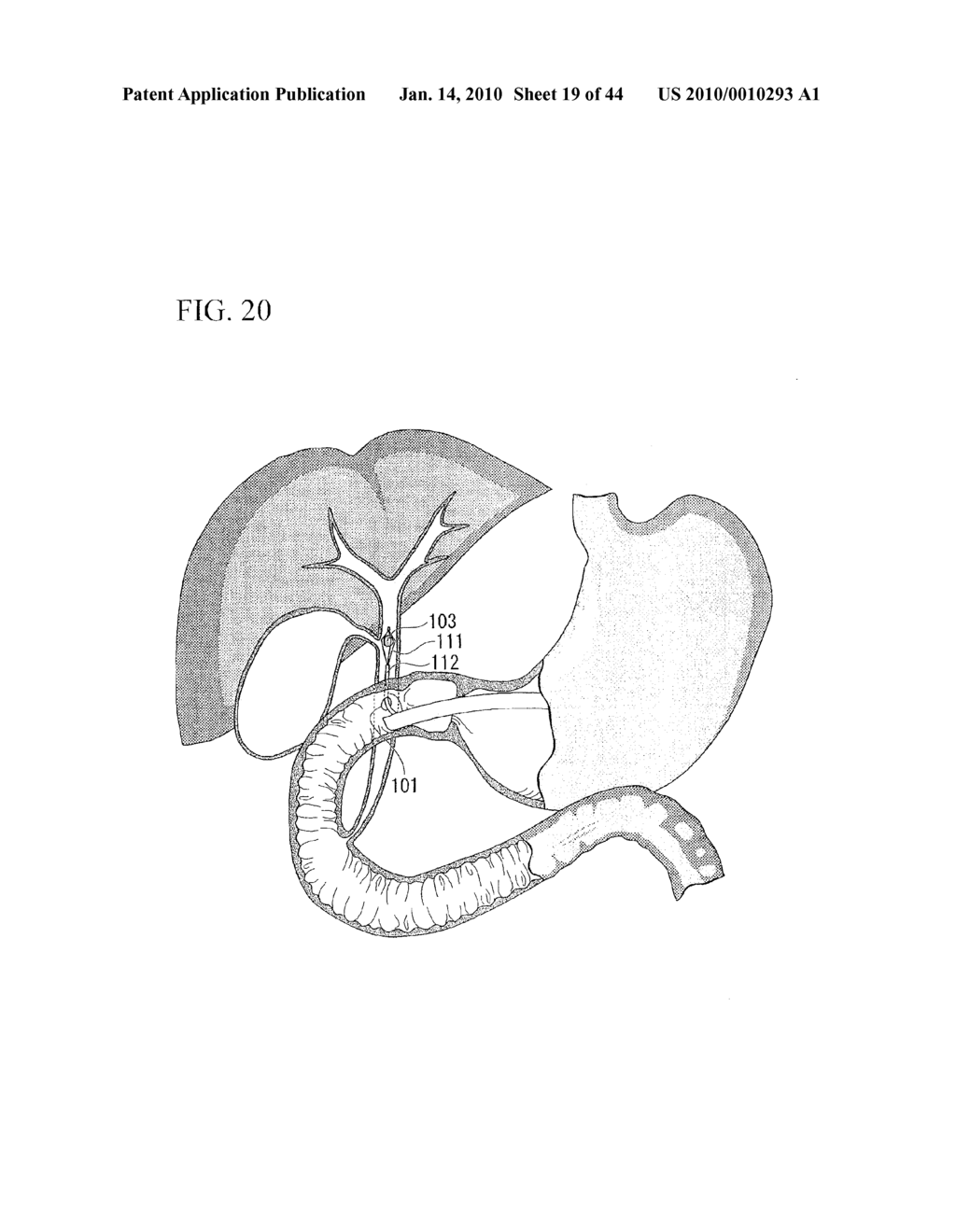 TREATMENT METHOD - diagram, schematic, and image 20