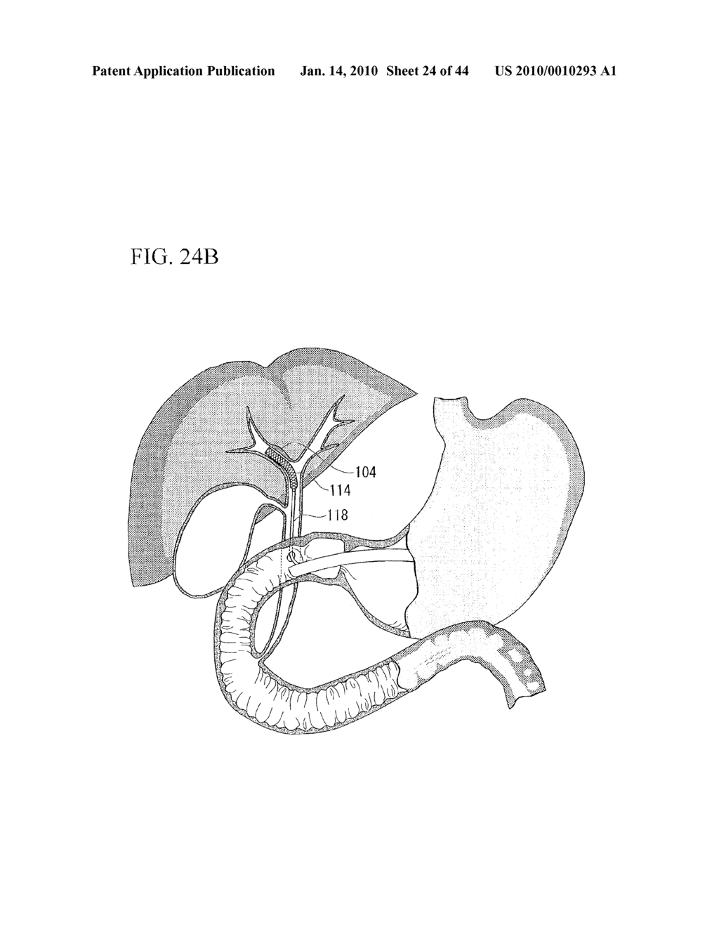 TREATMENT METHOD - diagram, schematic, and image 25