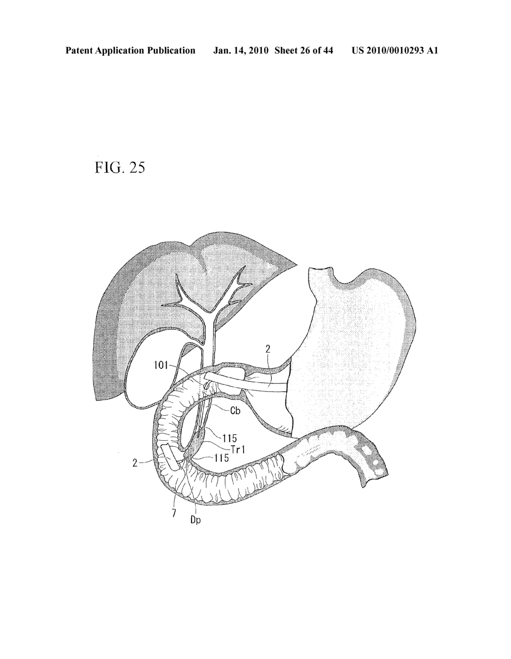 TREATMENT METHOD - diagram, schematic, and image 27