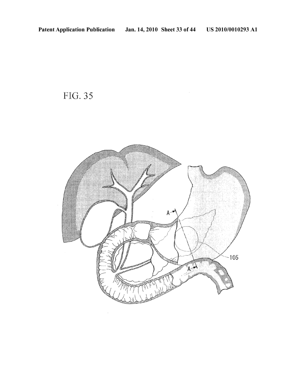 TREATMENT METHOD - diagram, schematic, and image 34