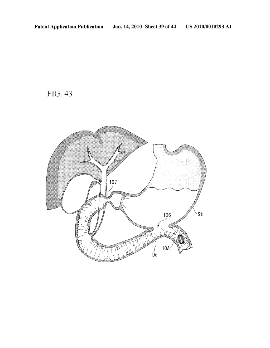 TREATMENT METHOD - diagram, schematic, and image 40