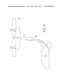 TEMPORARILY POSITIONABLE MEDICAL DEVICES diagram and image