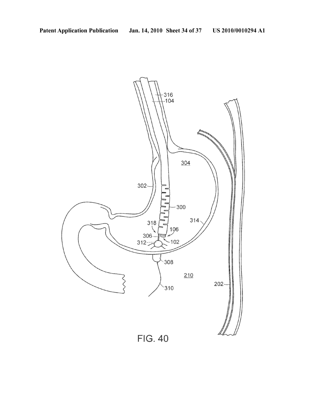 TEMPORARILY POSITIONABLE MEDICAL DEVICES - diagram, schematic, and image 35