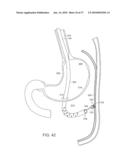 TEMPORARILY POSITIONABLE MEDICAL DEVICES diagram and image