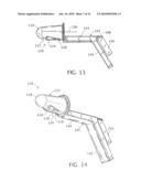ENDOLUMINAL TREATMENT METHOD AND ASSOCIATED SURGICAL ASSEMBLY INCLUDING TISSUE OCCLUSION DEVICE diagram and image
