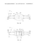 ENDOLUMINAL TREATMENT METHOD AND ASSOCIATED SURGICAL ASSEMBLY INCLUDING TISSUE OCCLUSION DEVICE diagram and image