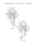 ENDOLUMINAL TREATMENT METHOD AND ASSOCIATED SURGICAL ASSEMBLY INCLUDING TISSUE OCCLUSION DEVICE diagram and image