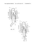 ENDOLUMINAL TREATMENT METHOD AND ASSOCIATED SURGICAL ASSEMBLY INCLUDING TISSUE OCCLUSION DEVICE diagram and image