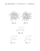 ENDOLUMINAL TREATMENT METHOD AND ASSOCIATED SURGICAL ASSEMBLY INCLUDING TISSUE OCCLUSION DEVICE diagram and image