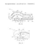 ENDOLUMINAL TREATMENT METHOD AND ASSOCIATED SURGICAL ASSEMBLY INCLUDING TISSUE OCCLUSION DEVICE diagram and image