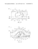 ENDOLUMINAL TREATMENT METHOD AND ASSOCIATED SURGICAL ASSEMBLY INCLUDING TISSUE OCCLUSION DEVICE diagram and image