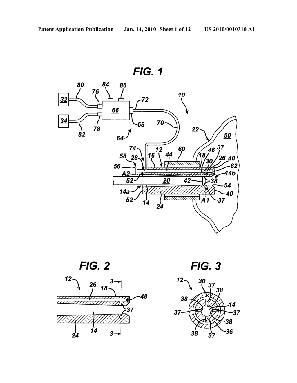 METHODS AND DEVICES FOR MAINTAINING VISIBILITY AND PROVIDING IRRIGATION AND/OR SUCTION DURING SURGICAL PROCEDURES - diagram, schematic, and image 02