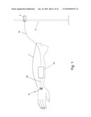 Temperature-compensated in-vivo sensor diagram and image