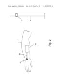 Temperature-compensated in-vivo sensor diagram and image