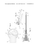 Temperature-compensated in-vivo sensor diagram and image