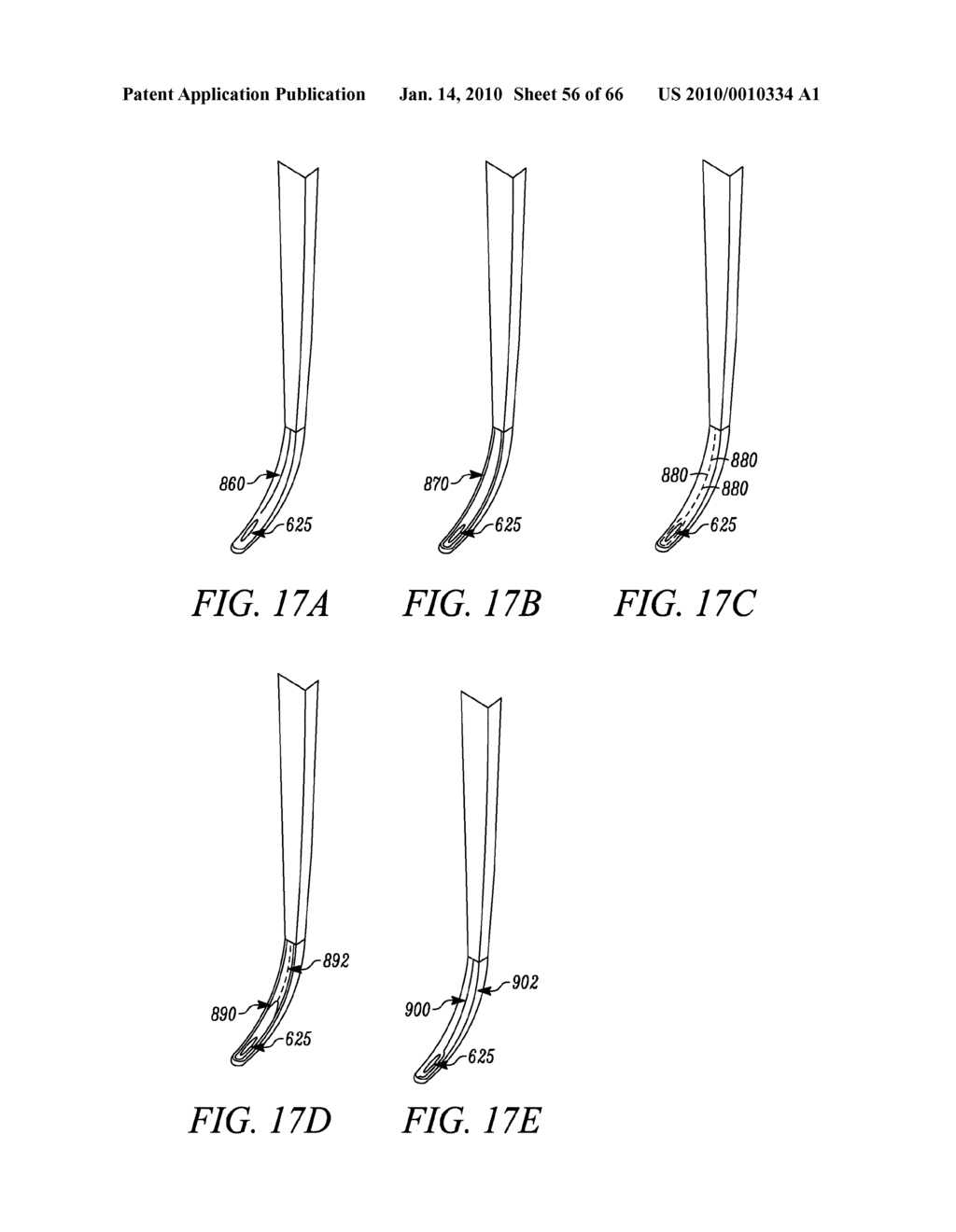 SPINAL ACCESS AND NEURAL LOCALIZATION - diagram, schematic, and image 57