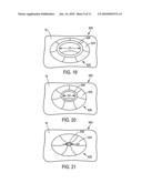 Body fluid sampling device - sampling site interface diagram and image