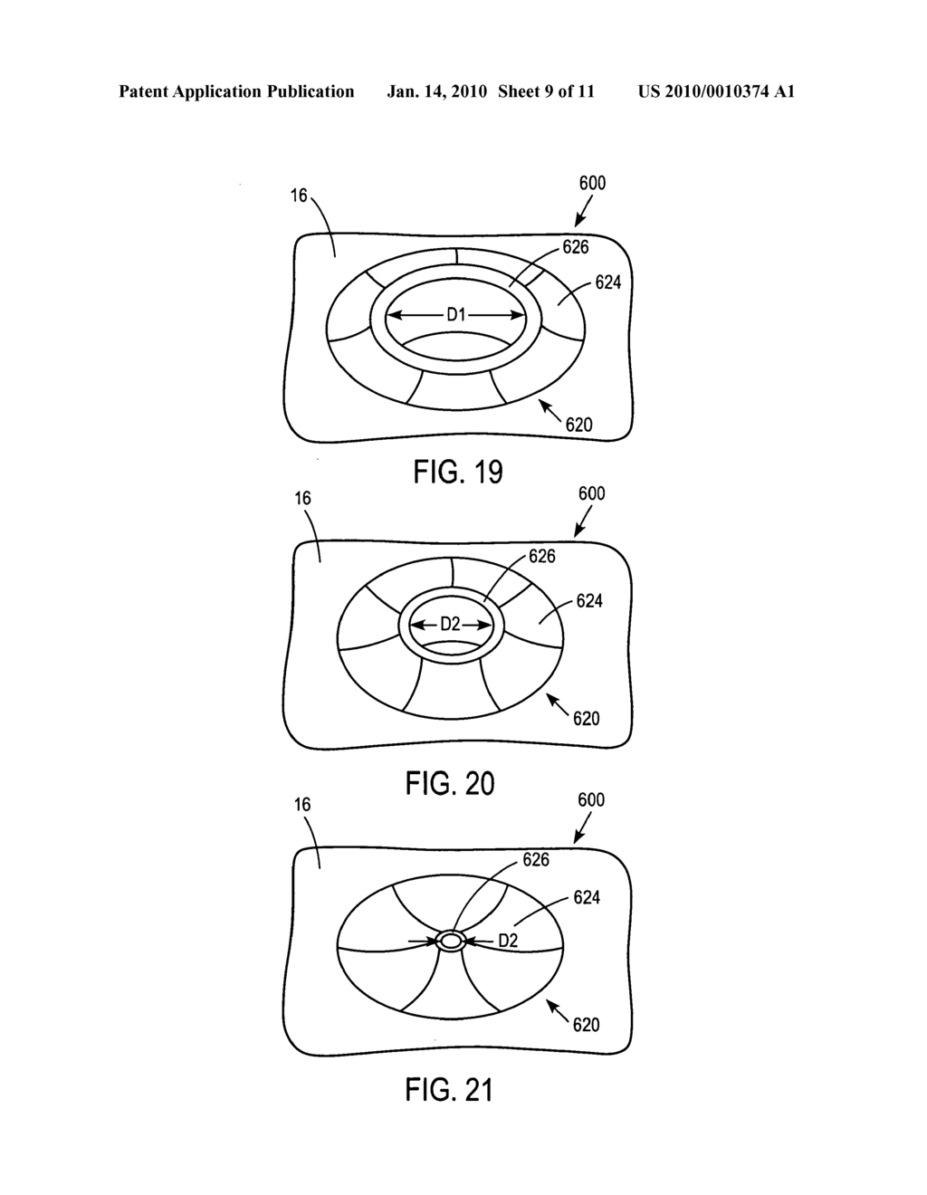 Body fluid sampling device - sampling site interface - diagram, schematic, and image 10