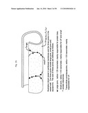 DIALYSIS SYSTEM HAVING INVENTORY MANAGEMENT INCLUDING ONLINE DEXTROSE MIXING diagram and image