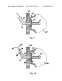 ANCHOR ASSEMBLY diagram and image