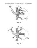 ANCHOR ASSEMBLY diagram and image