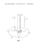 Cannula Stabilization Device, System, And Method Of Use diagram and image