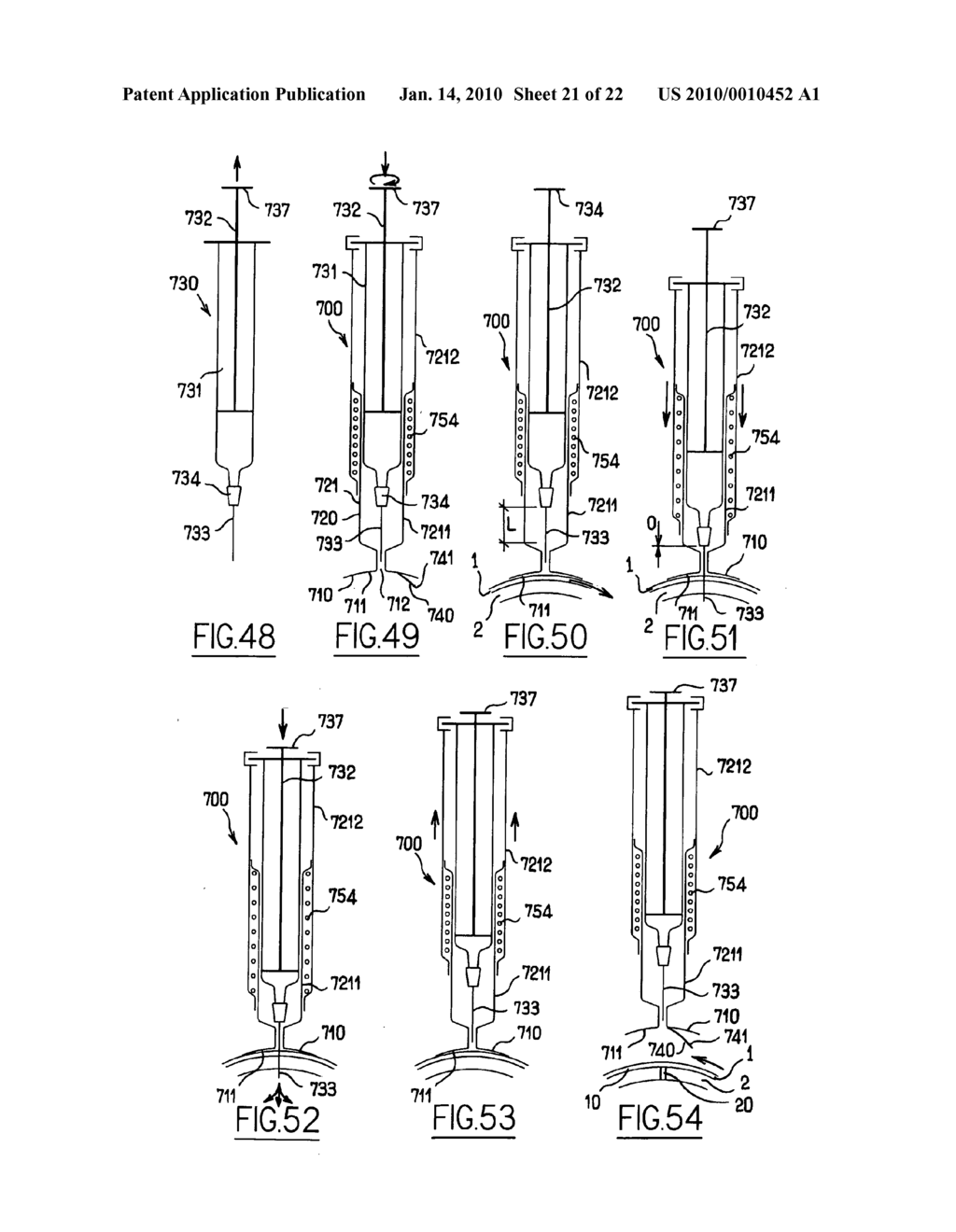 APPARATUS FOR INTRA-OCULAR INJECTION - diagram, schematic, and image 22