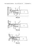 APPARATUS AND METHODS FOR FORMING GASTROINTESTINAL TISSUE APPROXIMATIONS diagram and image