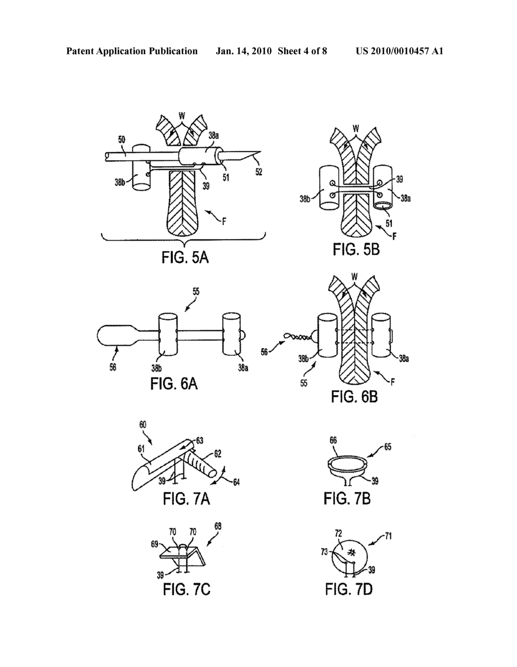 APPARATUS AND METHODS FOR FORMING GASTROINTESTINAL TISSUE APPROXIMATIONS - diagram, schematic, and image 05