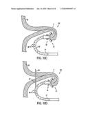 APPARATUS AND METHODS FOR FORMING GASTROINTESTINAL TISSUE APPROXIMATIONS diagram and image