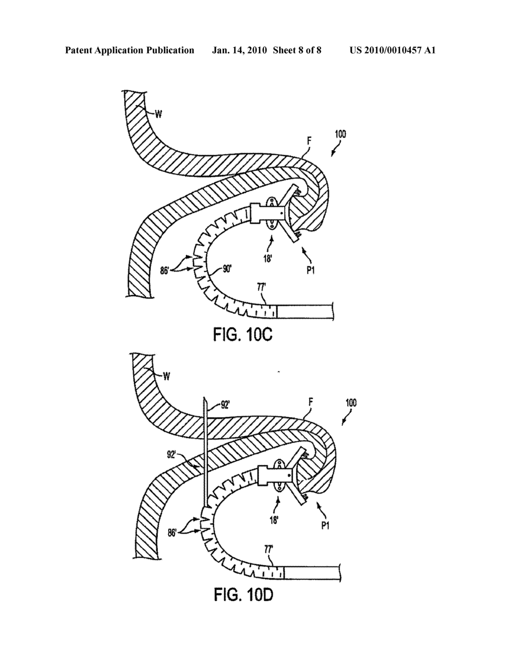 APPARATUS AND METHODS FOR FORMING GASTROINTESTINAL TISSUE APPROXIMATIONS - diagram, schematic, and image 09
