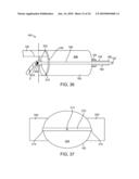 Retrobulbar Needle and Methods of Use diagram and image