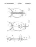 INTRAURETHRAL CATHETER diagram and image