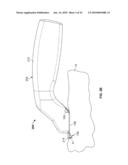 DEVICES AND METHODS FOR PERCUTANEOUS ENERGY DELIVERY diagram and image