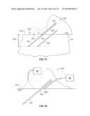 DEVICES AND METHODS FOR PERCUTANEOUS ENERGY DELIVERY diagram and image