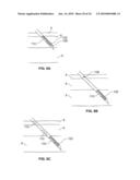 DEVICES AND METHODS FOR PERCUTANEOUS ENERGY DELIVERY diagram and image