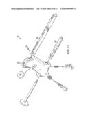 ANKLE ARTHRODESIS NAIL AND OUTRIGGER ASSEMBLY diagram and image