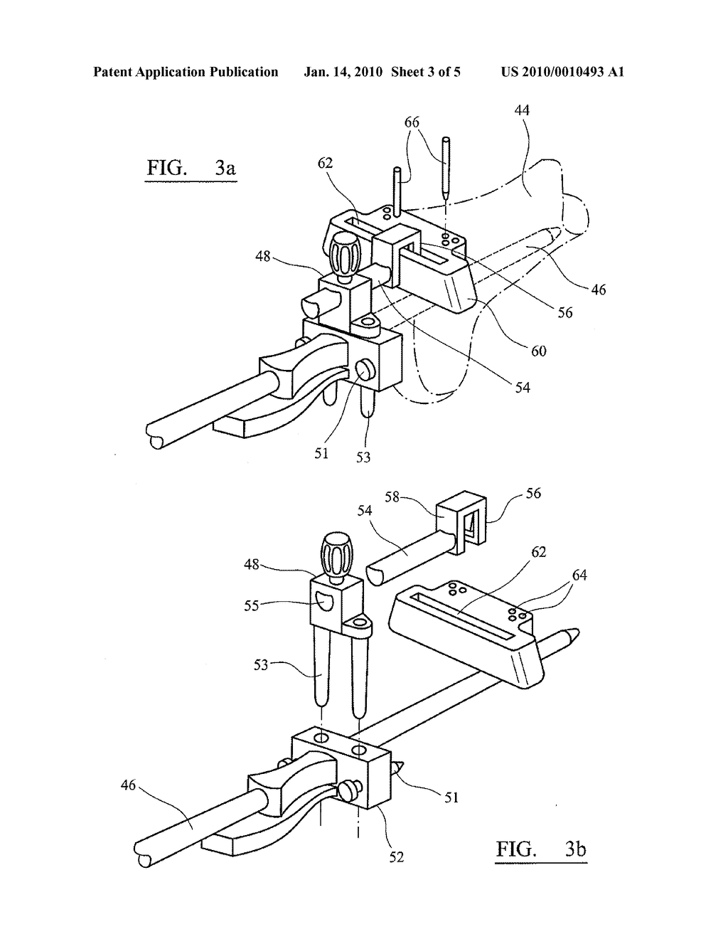 ORTHOPAEDIC CUTTING GUIDE INSTRUMENT - diagram, schematic, and image 04